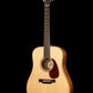 Circle Strings Dread, German Spruce/Figured Koa